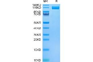 SDS-PAGE (SDS) image for Ectonucleotide pyrophosphatase/phosphodiesterase 3 (ENPP3) (AA 48-875) protein (His-Avi Tag,Biotin) (ABIN7274539)