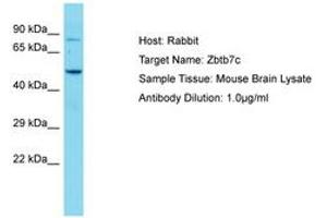 Image no. 1 for anti-Zinc Finger and BTB Domain Containing 7C (ZBTB7C) (AA 181-230) antibody (ABIN6750236) (ZBTB7C Antikörper  (AA 181-230))