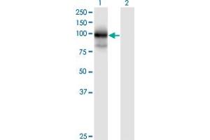Western Blot analysis of MGC16169 expression in transfected 293T cell line by MGC16169 monoclonal antibody (M01), clone 7A7. (TBCK Antikörper  (AA 601-700))
