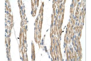 GPT antibody was used for immunohistochemistry at a concentration of 4-8 ug/ml. (ALT Antikörper)