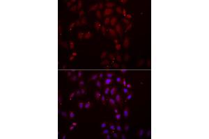 Immunofluorescence analysis of A549 cell using FRZB antibody. (FRZB Antikörper)