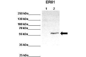 WB Suggested Anti-ETV1 Antibody    Positive Control:  Lane 1: 100ug untransfected HEK293 lysate Lane 2: 33ug ER81 transfected HEK293 lysate   Primary Antibody Dilution :   1:1000  Secondary Antibody :  Anti-rabbit-HRP   Secondry Antibody Dilution :   1:2000  Submitted by:  Anonymous (ETV1 Antikörper  (Middle Region))