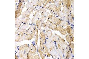 Immunohistochemistry of paraffin-embedded rat heart using MBNL1 antibody. (MBNL1 Antikörper  (AA 1-382))