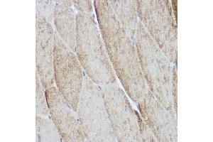Immunohistochemistry of paraffin-embedded mouse skeletal muscle using  Rabbit pAb (ABIN6127422, ABIN6136487, ABIN6136489 and ABIN6216551) at dilution of 1:500 (40x lens). (ACTN3 Antikörper  (AA 580-630))