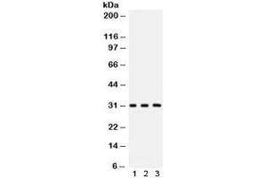 Western blot testing of 1) rat brain, 2) mouse brain and 3) human HeLa lysate with Peroxiredoxin 4 antibody. (Peroxiredoxin 4 Antikörper)