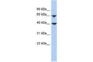 WB Suggested Anti-APOBEC4 Antibody Titration: 0. (APOBEC4 Antikörper  (N-Term))