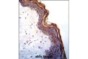 Kallikrein 7(KLK7) Antibody immunohistochemistry analysis in formalin fixed and paraffin embedded human skin tissue followed by peroxidase conjugation of the secondary antibody and DAB staining. (Kallikrein 7 Antikörper  (C-Term))