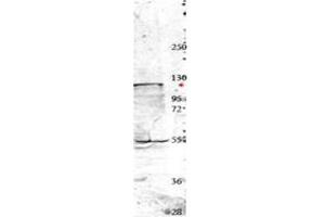 Image no. 1 for anti-Neural Precursor Cell Expressed, Developmentally Down-Regulated 4, E3 Ubiquitin Protein Ligase (NEDD4) (Internal Region) antibody (ABIN293884)