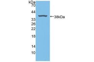 Figure. (Biliverdin Reductase Antikörper  (AA 10-279))
