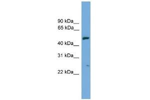 WB Suggested Anti-EXOC4 Antibody Titration: 0. (Sec8 Antikörper  (N-Term))