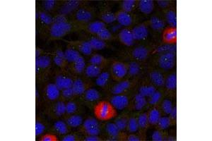 Immunofluorescence staining of methanol-fixed HeLa cells using EIF4G1 polyclonal antibody . (EIF4G1 Antikörper  (Ser1232))