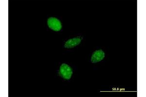 Immunofluorescence of monoclonal antibody to GTF2A1L on HeLa cell. (GTF2A1L Antikörper  (AA 251-348))