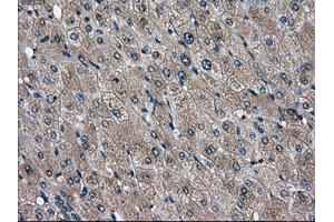 Immunohistochemical staining of paraffin-embedded liver tissue using anti-DPP4mouse monoclonal antibody. (DPP4 Antikörper)
