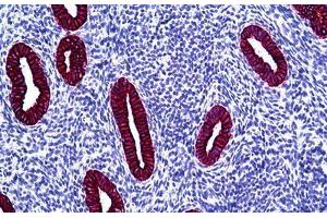 Human Uterus: Formalin-Fixed, Paraffin-Embedded (FFPE) (Keratin Basic Antikörper)