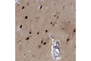 Immunohistochemical staining of human cerebral cortex with SOX7 polyclonal antibody  shows strong nuclear positivity in neuronal cells at 1:50-1:200 dilution. (PINX1 Antikörper)