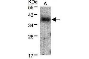 WB Image Sample(30 μg of whole cell lysate) A:A431, 12% SDS PAGE antibody diluted at 1:1500 (Crk Antikörper  (Center))