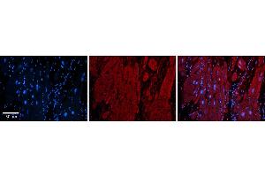 Rabbit Anti-ZFP36L1 Antibody  Catalog Number: ARP33382_P050 Formalin Fixed Paraffin Embedded Tissue: Human Adult heart  Observed Staining: Cytoplasmic Primary Antibody Concentration: 1:600 Secondary Antibody: Donkey anti-Rabbit-Cy2/3 Secondary Antibody Concentration: 1:200 Magnification: 20X Exposure Time: 0. (ZFP36L1 Antikörper  (N-Term))