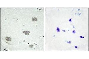 Immunohistochemistry analysis of paraffin-embedded human brain, using CSFR (Phospho-Tyr809) Antibody. (CSF1R Antikörper  (pTyr809))