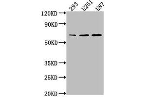 Western Blot Positive WB detected in: 293 whole cell lysate, U251 whole cell lysate, U87 whole cell lysate All lanes: TCF7L1 antibody at 1:1000 Secondary Goat polyclonal to rabbit IgG at 1/50000 dilution Predicted band size: 63 kDa Observed band size: 63 kDa (TCF7L1 Antikörper  (AA 80-99))