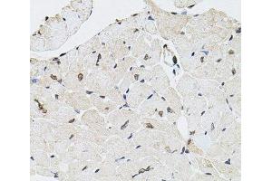 Immunohistochemistry of paraffin-embedded Mouse heart using GTF2H2 Polyclonal Antibody at dilution of 1:100 (40x lens).