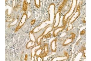 ABIN6262070 and ABIN6276489 at 1/100 staining human normal kidney tissue by IHC-P. (GPX5 Antikörper  (Internal Region))
