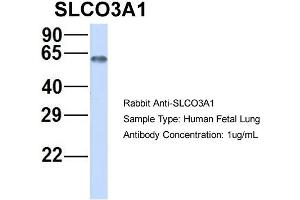 Host:  Rabbit  Target Name:  SLCO3A1  Sample Type:  Human Fetal Lung  Antibody Dilution:  1.