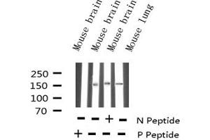 Western blot analysis of Phospho-Bcr (Tyr177) expression in various lysates (BCR Antikörper  (pTyr177))