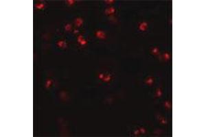 Immunofluorescence staining of human spleen tissue with 20 ug/mL NLRP3 polyclonal antibody . (NLRP3 Antikörper  (AA 120-170))