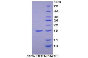 SDS-PAGE (SDS) image for Retinol Binding Protein 2, Cellular (RBP2) (AA 1-134) protein (His tag) (ABIN1080636) (RBP2 Protein (AA 1-134) (His tag))