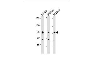 Western Blotting (WB) image for anti-Villin 1 (VIL1) (AA 180-207), (N-Term) antibody (ABIN390742)