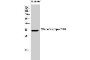 Western Blotting (WB) image for anti-Olfactory Receptor, Family 5, Subfamily W, Member 2 (OR5W2) (Internal Region) antibody (ABIN3186172) (OR5W2 Antikörper  (Internal Region))