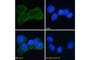 Immunofluorescence staining of fixed MCF7 cells with anti-Insulin receptor alpha antibody Fab 83-7. (Rekombinanter ISR-alpha Antikörper)