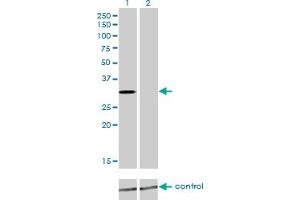 Western blot analysis of KCNIP2 over-expressed 293 cell line, cotransfected with KCNIP2 Validated Chimera RNAi (Lane 2) or non-transfected control (Lane 1).