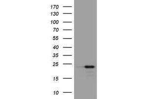 Image no. 1 for anti-Visinin-Like 1 (VSNL1) (AA 2-191) antibody (ABIN1491148)