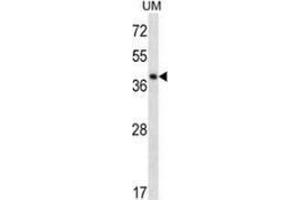 Western Blotting (WB) image for anti-Speckle-Type POZ Protein-Like (SPOPL) (AA 228-357), (Middle Region) antibody (ABIN954939)