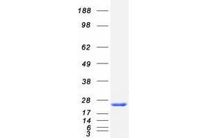 Western Blotting (WB) image for Neuronal Calcium Sensor 1 (NCS1) (Transcript Variant 1) protein (Myc-DYKDDDDK Tag) (ABIN2726909)