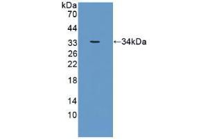 Western blot analysis of recombinant Human CRAT. (CRAT Antikörper  (AA 363-626))