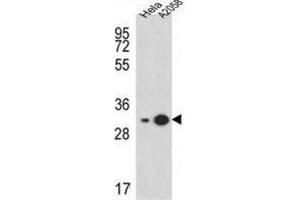 Western Blotting (WB) image for anti-Ribosomal Protein S3A (RPS3A) antibody (ABIN3002375) (RPS3A Antikörper)