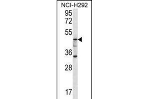 GBA3 Antibody (C-term) (ABIN656223 and ABIN2845539) western blot analysis in NCI- cell line lysates (35 μg/lane). (GBA3 Antikörper  (C-Term))
