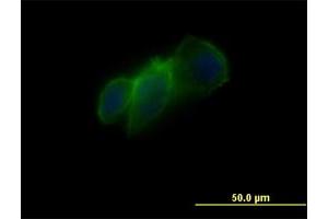 Immunofluorescence of monoclonal antibody to CDH11 on PC3-MM2 cell. (OB Cadherin Antikörper  (AA 54-612))