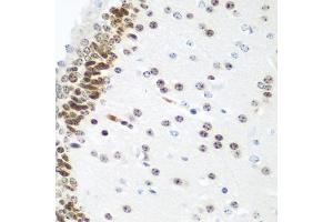 Immunohistochemistry of paraffin-embedded mouse brain using UBE2U antibody (ABIN6130858, ABIN6149825, ABIN6149826 and ABIN6224418) at dilution of 1:100 (40x lens). (UBE2U Antikörper  (AA 1-226))