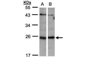 WB Image Sample(30 ug whole cell lysate) A:293T B:Hep G2 , 12% SDS PAGE antibody diluted at 1:1000 (ITPA Antikörper)