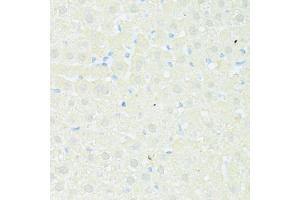 Immunohistochemistry of paraffin-embedded rat liver using TRIM15 antibody (ABIN5999102) at dilution of 1/100 (40x lens). (TRIM15 Antikörper)