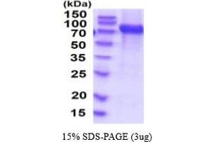 SDS-PAGE (SDS) image for Vascular Cell Adhesion Molecule 1 (VCAM1) (AA 25-698) (Active) protein (His tag) (ABIN5854738)
