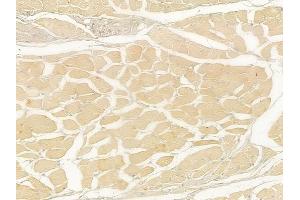 ABIN6258589 and ABIN6275045 at 1/100 staining human tongue carcinoma by IHC-P. (ATG4C Antikörper  (N-Term))