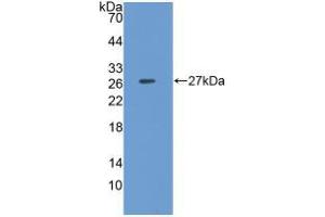 Western blot analysis of recombinant Pig CLU. (Clusterin Antikörper  (AA 229-446))