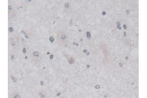 Immunohistochemistry (IHC) image for anti-Lactamase, beta (LACTB) (AA 313-547) antibody (ABIN7436687)