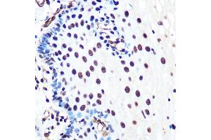 Immunohistochemistry (IHC) image for anti-X-Ray Repair Complementing Defective Repair in Chinese Hamster Cells 5 (Double-Strand-Break Rejoining) (XRCC5) antibody (ABIN7271406)