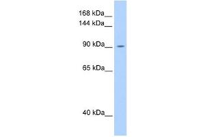 OSMR antibody used at 1 ug/ml to detect target protein. (Oncostatin M Receptor Antikörper  (N-Term))