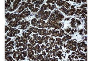 Immunohistochemistry (IHC) image for anti-Hydroxysteroid (17-Beta) Dehydrogenase 8 (HSD17B8) (AA 57-261) antibody (ABIN2715557) (HSD17B8 Antikörper  (AA 57-261))